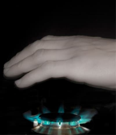 Alterações da sensibilidade - Hipoestesia e Parestesias