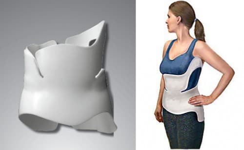 escoliose 2 - Dr Ernani Abreu.jpg