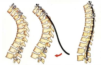 cifose 2 - Dr Ernani Abreu.jpg