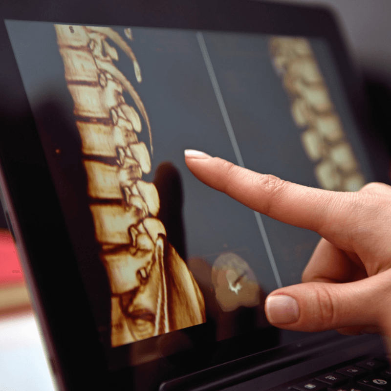 Duvidas Comuns sobre a Coluna e Dores Relacionadas